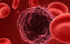 Ελπιδοφόρο μήνυμα: Ο καρκίνος τα επόμενα 10 χρόνια θα είναι χρόνιο νόσημα